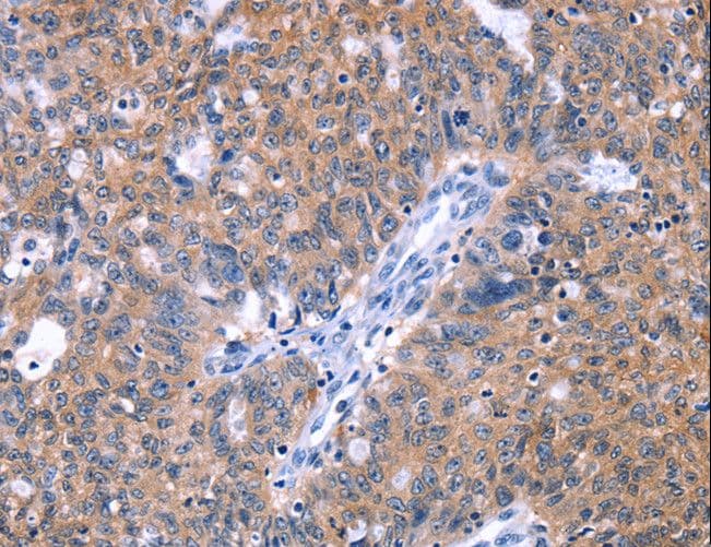 ZNF395 Antibody