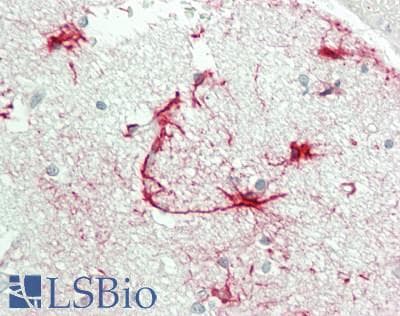 IHC-plus™ OR7C1 Antibody (aa199-248)