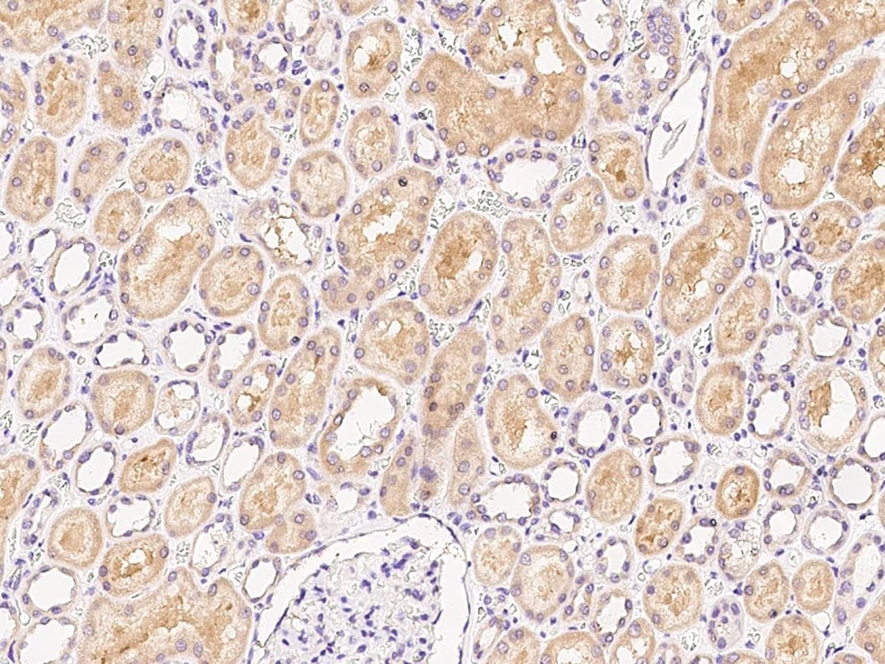 RAB1A Antibody (Preservative Free)