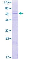 Human DNAJB14 Protein (Recombinant GST)