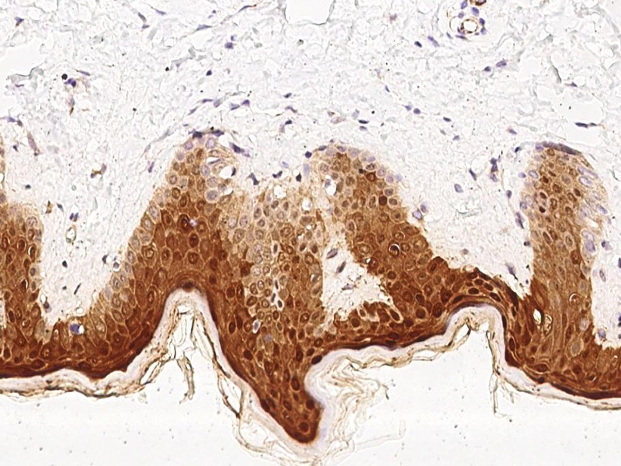 CASP14 / Caspase 14 Antibody (clone 20, Preservative Free)