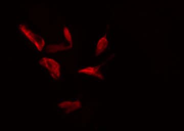 Polyclonal Rabbit anti-Human RPS4X Antibody (IF, WB)