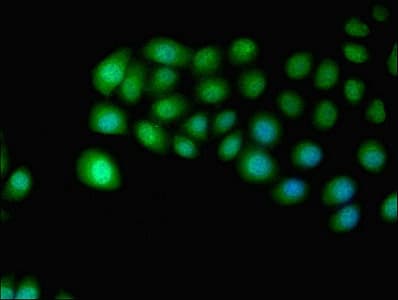 Polyclonal Rabbit anti-Human IDO2 / INDOL1 Antibody (aa1-407, WB)