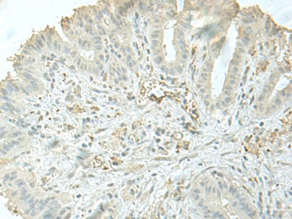 Polyclonal Rabbit anti-Human C8orf4 Antibody (IHC)