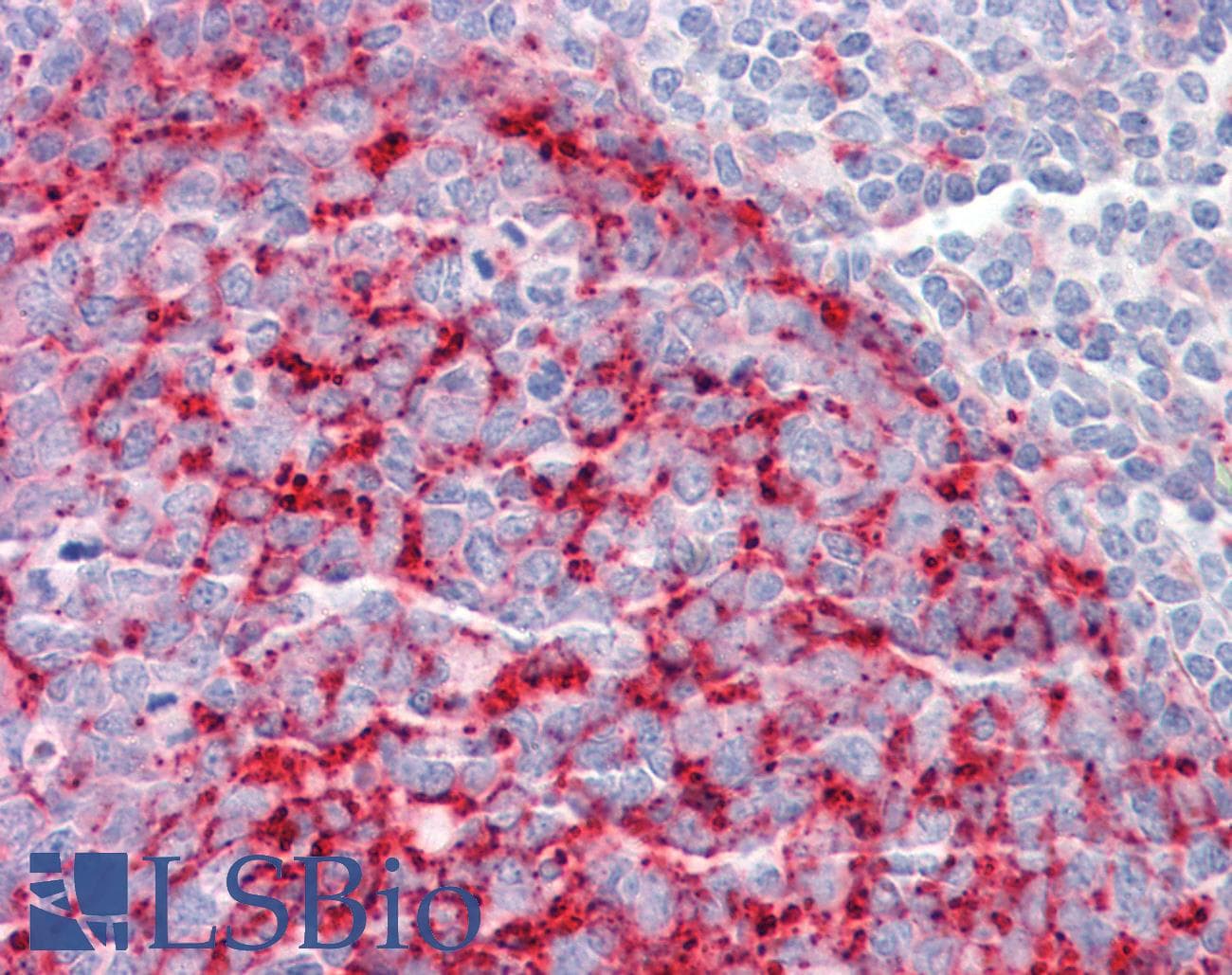 IHC-plus™ Polyclonal Rabbit anti-Human YPEL2 Antibody (IHC, IF, WB)