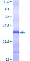 Human CHRNA3 Protein (Recombinant GST, N-terminus)