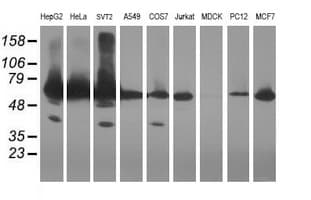 GCP60 / ACBD3 Antibody (clone OTI1B5)