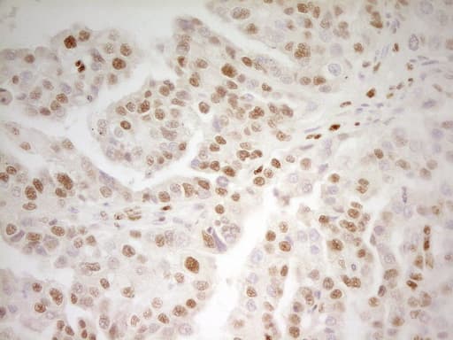 MEF2D Antibody (aa1-282, clone OTI3D12)