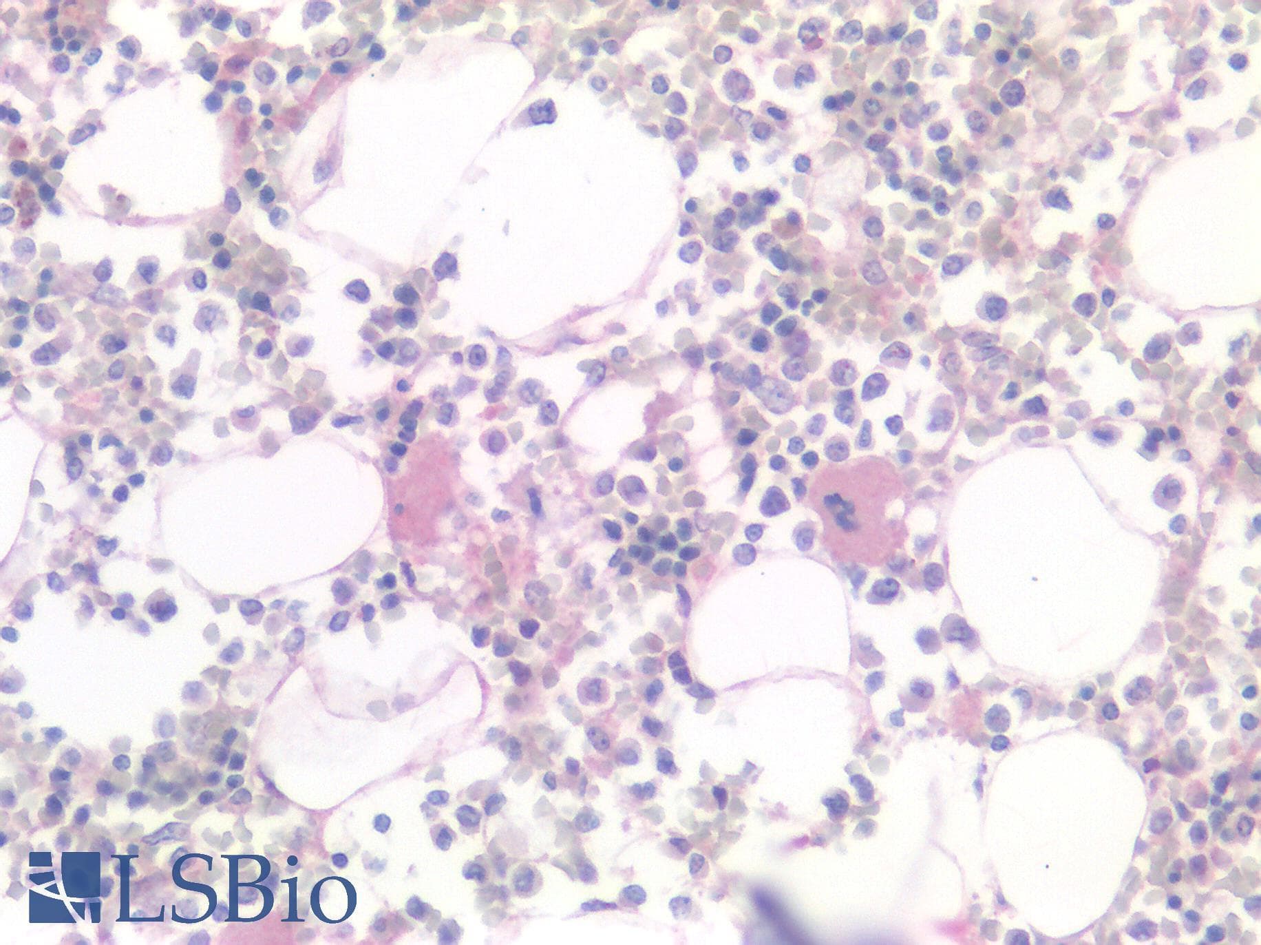 IHC-plus™ Polyclonal Rabbit anti-Human MSLN / Mesothelin Antibody (IHC)