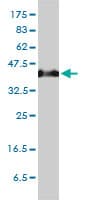 SERPINH1 / HSP47 Antibody (clone 1D2-1A6)