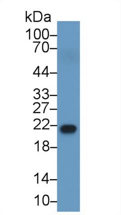 RBP4 Antibody (aa18-201)