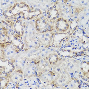 KLK3 / PSA Antibody