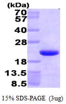 Human HMGN1 / HMG14 Protein (Recombinant His)