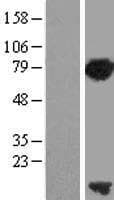 PCNA-Associated Factor Protein (Over-Expression Lysate Myc-DDK (Flag))