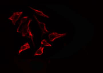Polyclonal Rabbit anti-Human ARSF / Arylsulfatase F Antibody (IF, WB)