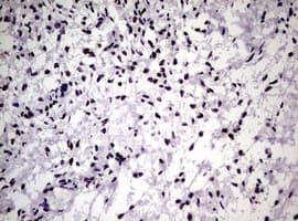 NBN / Nibrin Antibody (clone OTI6H7)