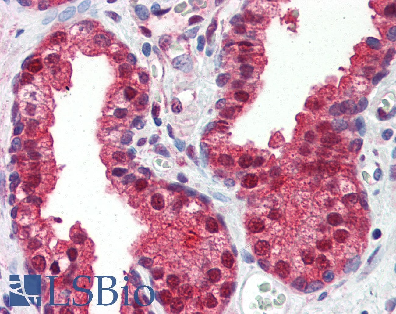 IHC-plus™ Monoclonal Mouse anti-Human FOLH1 / PSMA Antibody (clone K1H7, aa117-351, IHC, WB)