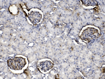 Polyclonal Rabbit anti-Mouse CRP / C-Reactive Protein Antibody (IHC, WB)