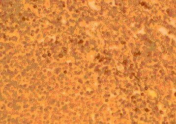 Polyclonal Goat anti-Human CCR2 Antibody (aa17-39, IHC, WB)