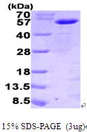 Human MNDA Protein (Recombinant His)