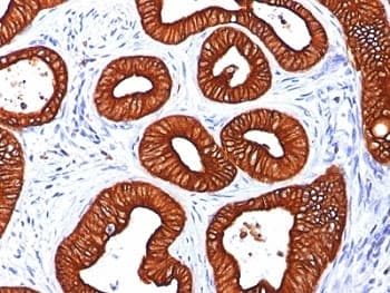 KRT18 / CK18 / Cytokeratin 18 Antibody (clone KRT18/834)