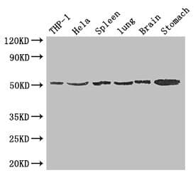 MSR1 / CD204 Antibody