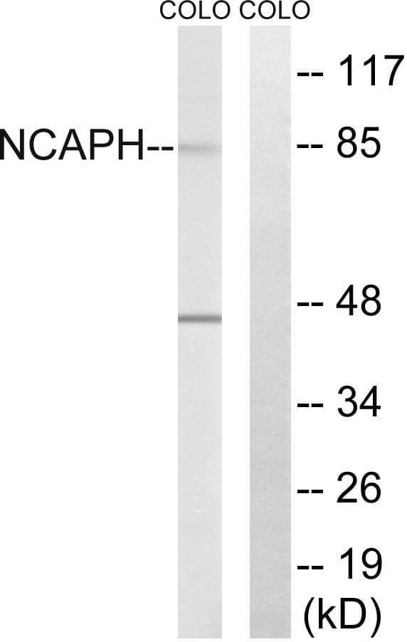 Polyclonal Rabbit anti-Human NCAPH / CAP-H Antibody (WB)