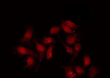 Polyclonal Rabbit anti-Human ERBB2 / HER2 Antibody (phospho-Tyr1112, IHC, IF, WB)