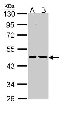 EPHX1 / Epoxide Hydrolase 1 Antibody (aa14-292)
