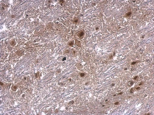 IHC-plus™ AXIN2 / Axin 2 Antibody (Internal)
