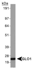 GLO1 / Glyoxalase I Antibody (clone Glo1a)
