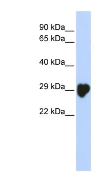 CA1 / Carbonic Anhydrase I Antibody (N-Terminus)