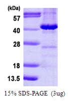 Human MAPRE2 / EB2 Protein (Recombinant His)
