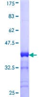 Human CACNA1S / Cav1.1 Protein (Recombinant GST, N-terminus)