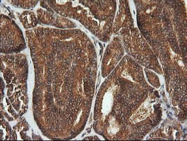 CDKN2B / p15 INK4b Antibody (clone OTI8H4, Carrier-free)