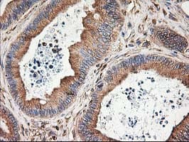 Monoclonal Mouse anti-Human TUBB4 / Tubulin Beta 4 Antibody (clone OTI5C1, IHC, IF, WB)