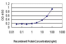 PHKG1 Antibody (clone 2B4)