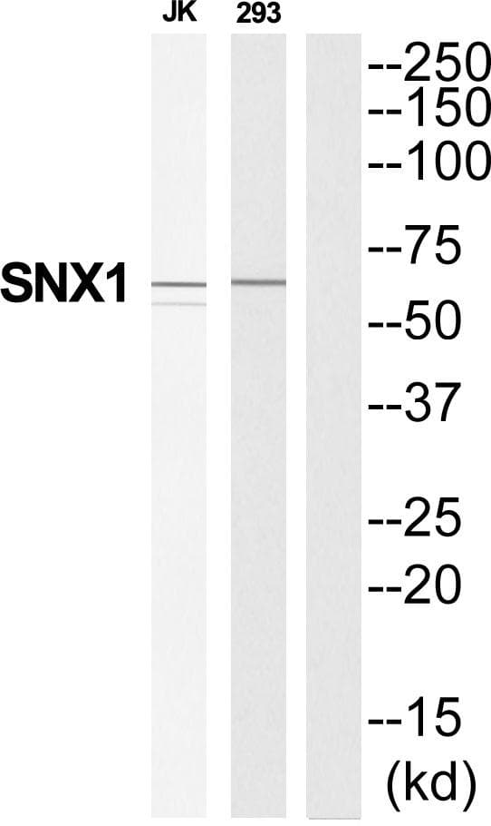 Polyclonal Rabbit anti-Human SNX1 Antibody (WB)