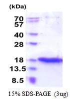 Human ZG16 Protein (Recombinant His)