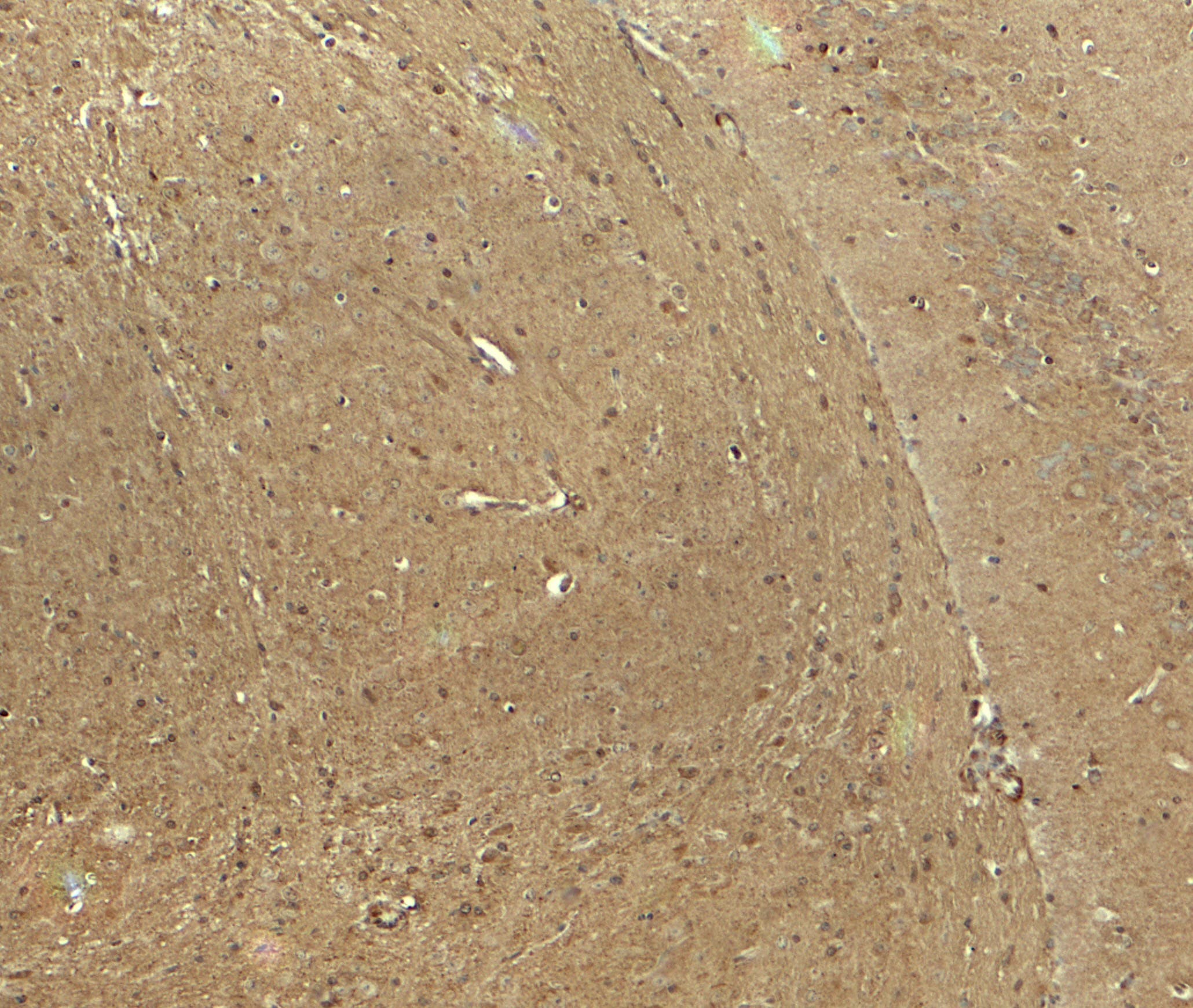 NECL-1 / CADM3 Antibody