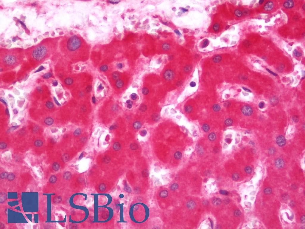 Polyclonal Rabbit anti-Human CYB5A / Cytochrome b5 Antibody (HRP, IHC, WB)