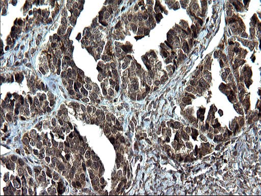 Monoclonal Mouse anti-Human IRF5 Antibody (clone OTI1G7, IHC, WB)