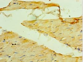 Polyclonal Rabbit anti-Human MYOT / Myotilin Antibody (aa443-498, IHC)