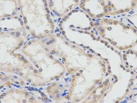 Polyclonal Rabbit anti-Human ERCC1 Antibody (IHC, IF, WB)