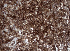 CD99 Antibody (clone OTI5C1)