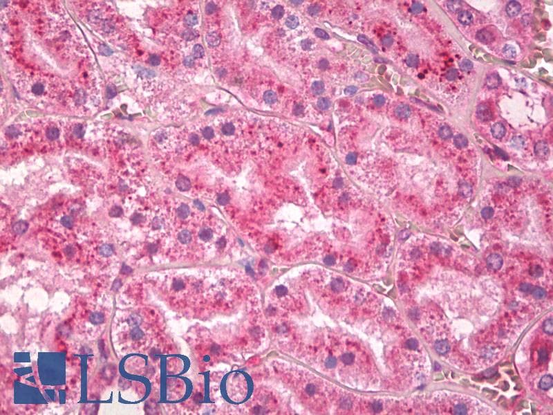 IHC-plus™ RYR3 / Ryanodine Receptor 3 Antibody (TM Region)