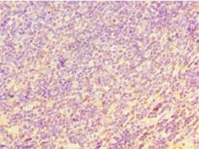 Polyclonal Rabbit anti-Human YKL39 / CHI3L2 Antibody (aa27-390, IHC, WB)