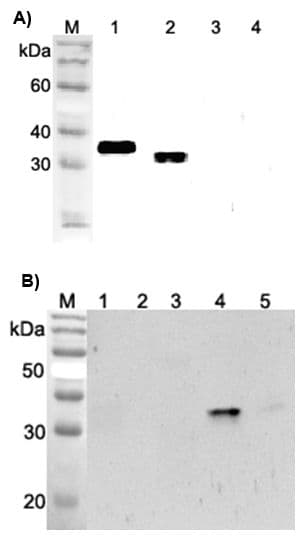 ANGPTL4 Antibody (Fibrinogen-like domain)