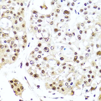 TET2 Antibody