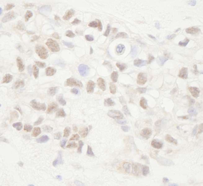 APC Antibody (aa1-50)